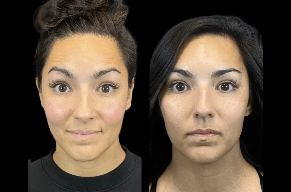 Inside the Best Aesthetic Clinic in Dubai: Advanced Technology That Transforms Beauty