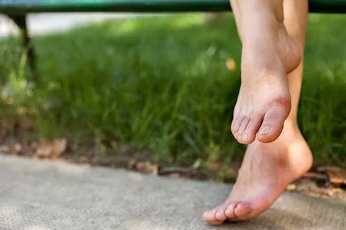 Find Relief for Tired and Aching Feet in Edinburgh